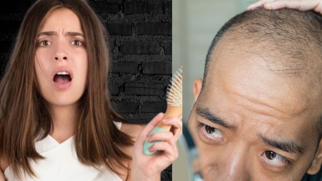 hair loss